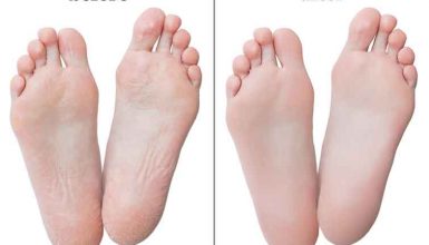 The Foot Callus Remover