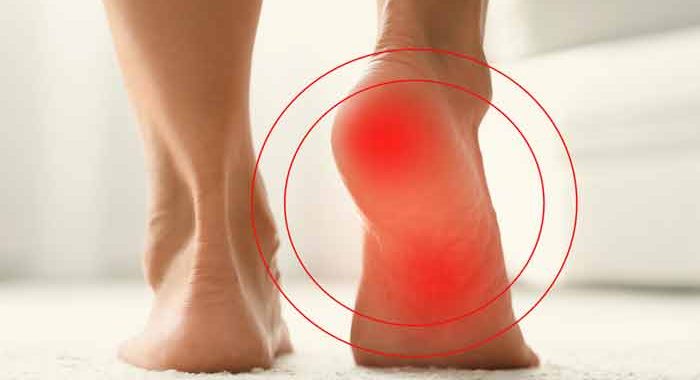 How Can I Stop Nerve Pain In My Foot