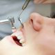 Why Dental Cleanings Are Essential to Oral Hygiene